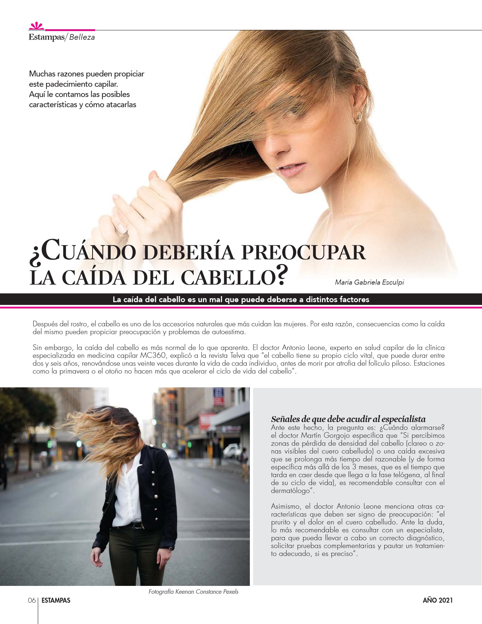 6-REV Belleza María Gabriela Esculpi Cuándo debería preocupar la caída del cabello
